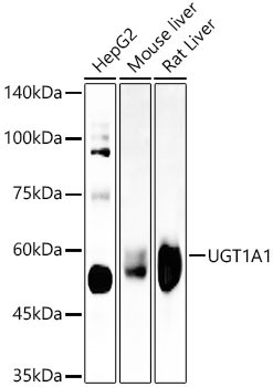 UGT1A1 Antibody in Western Blot (WB)