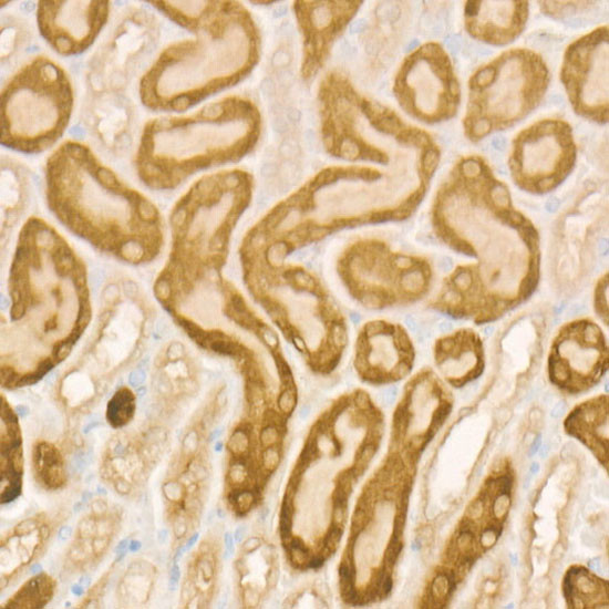 IREB2 Antibody in Immunohistochemistry (Paraffin) (IHC (P))