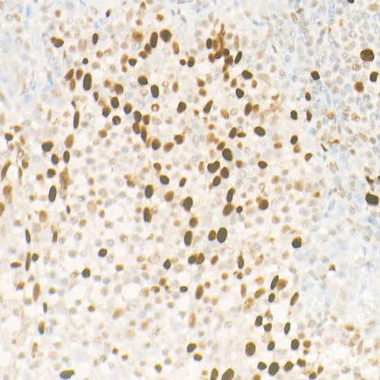 HELLS Antibody in Immunohistochemistry (Paraffin) (IHC (P))