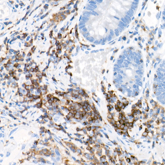 PKC beta Antibody in Immunohistochemistry (Paraffin) (IHC (P))