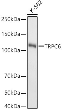 TRPC6 Antibody in Western Blot (WB)