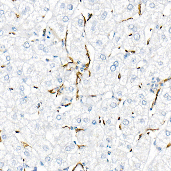 TNF alpha Antibody in Immunohistochemistry (Paraffin) (IHC (P))