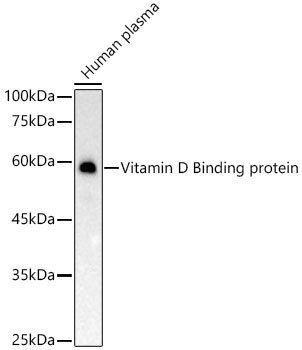 GC Antibody in Western Blot (WB)