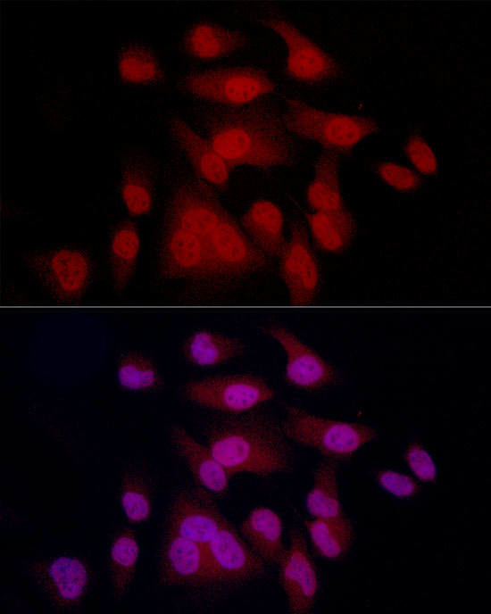 MiTF Antibody in Immunocytochemistry (ICC/IF)