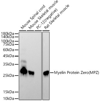 MPZ Antibody in Western Blot (WB)
