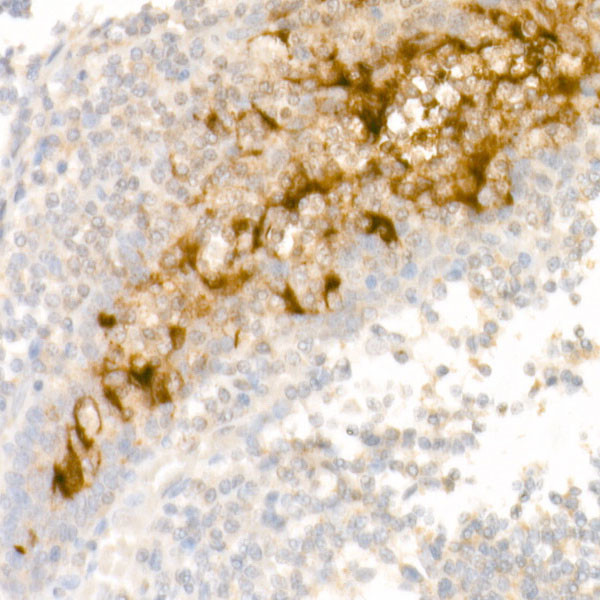Mesothelin Antibody in Immunohistochemistry (Paraffin) (IHC (P))