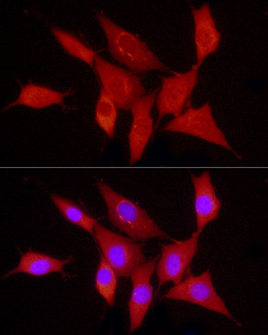 PDGF-B Antibody in Immunocytochemistry (ICC/IF)