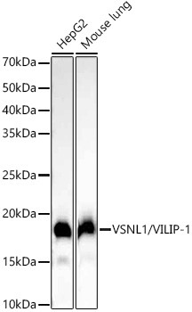 VSNL1 Antibody in Western Blot (WB)