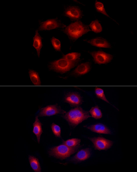 Melan-A Antibody in Immunocytochemistry (ICC/IF)