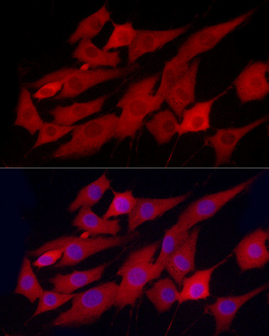 PHGDH Antibody in Immunocytochemistry (ICC/IF)