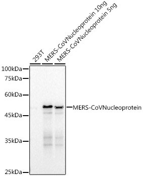 MERS Coronavirus NP Antibody in Western Blot (WB)