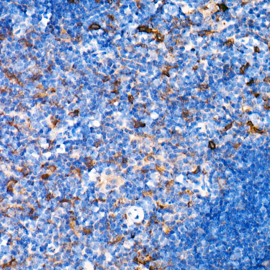Interferon alpha-2 Antibody in Immunohistochemistry (Paraffin) (IHC (P))
