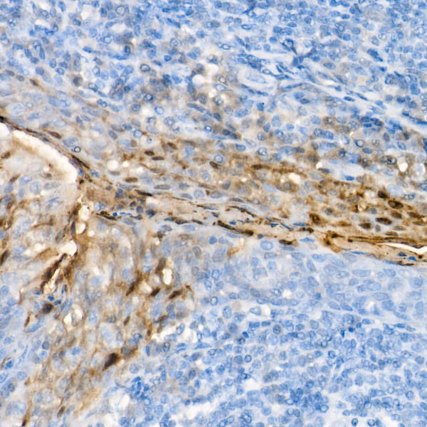 S100A7 Antibody in Immunohistochemistry (Paraffin) (IHC (P))
