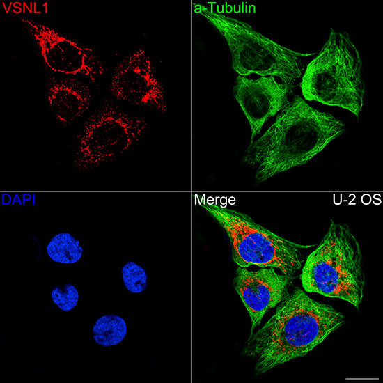 VSNL1 Antibody in Immunocytochemistry (ICC/IF)