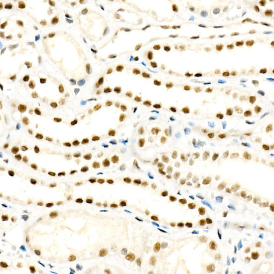 ALKBH5 Antibody in Immunohistochemistry (Paraffin) (IHC (P))