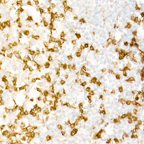 CD3z Antibody in Immunohistochemistry (Paraffin) (IHC (P))