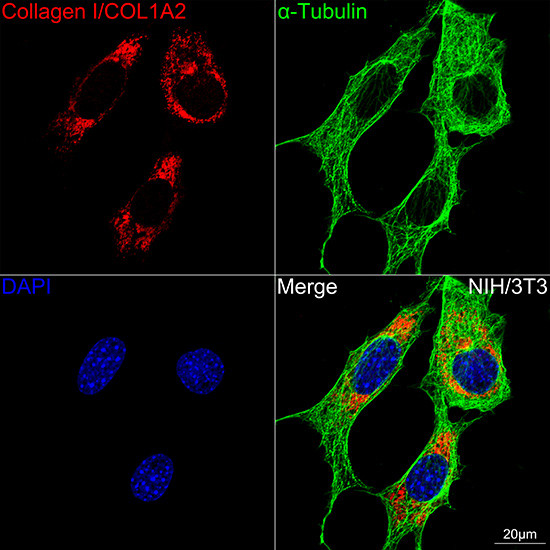 COL1A2 Antibody in Immunocytochemistry (ICC/IF)