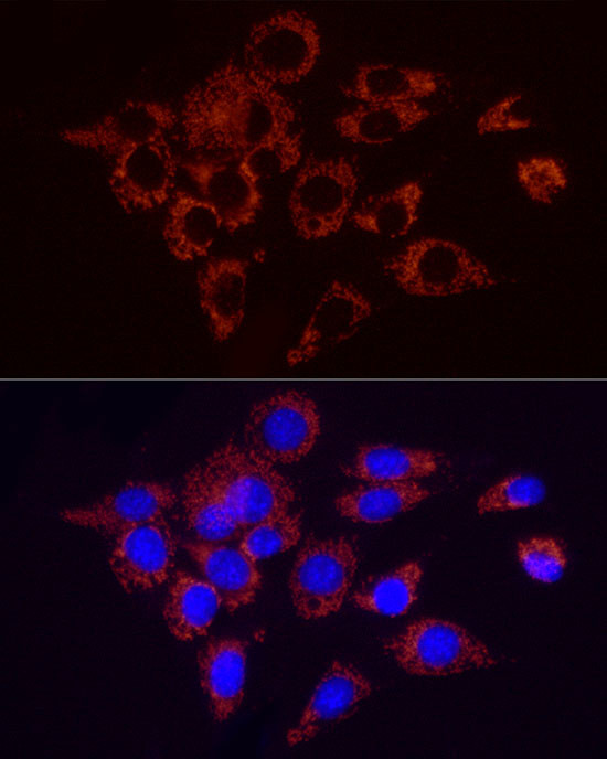 SDHC Antibody in Immunocytochemistry (ICC/IF)