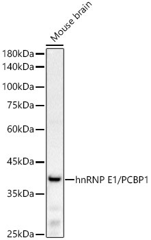PCBP1 Antibody in Western Blot (WB)