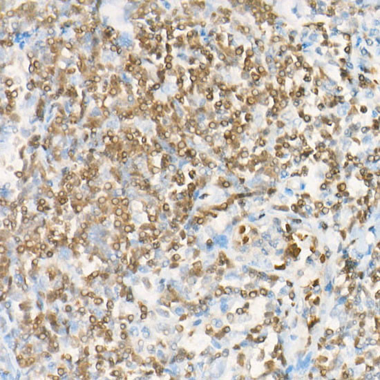 DGKA Antibody in Immunohistochemistry (Paraffin) (IHC (P))