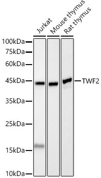 TWF2 Antibody in Western Blot (WB)