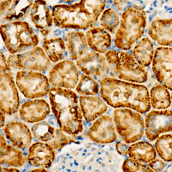 FUNDC1 Antibody in Immunohistochemistry (Paraffin) (IHC (P))