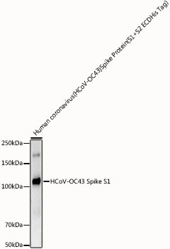 HCoV-OC43 Spike S1 Antibody in Western Blot (WB)