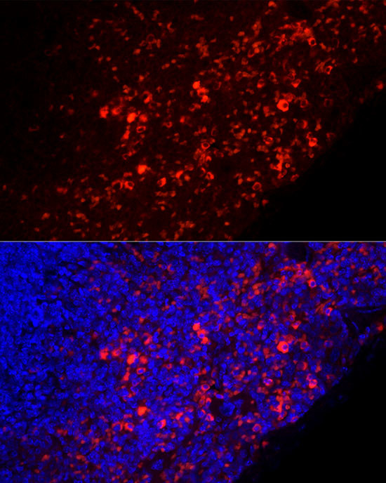 Mouse IgM Antibody in Immunocytochemistry (ICC/IF)
