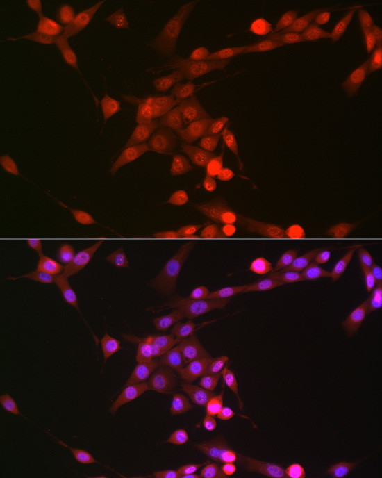 Phospho-p38 MAPK alpha (Tyr182) Antibody in Immunocytochemistry (ICC/IF)