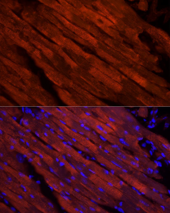 Cardiac Troponin I Antibody in Immunocytochemistry (ICC/IF)