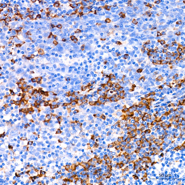 CDA Antibody in Immunohistochemistry (Paraffin) (IHC (P))