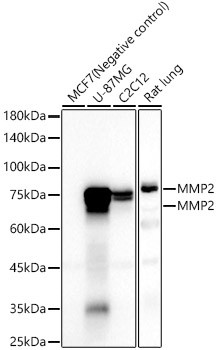 MMP2 Antibody in Western Blot (WB)