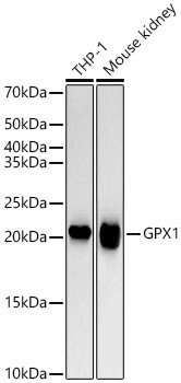GPX1 Antibody in Western Blot (WB)
