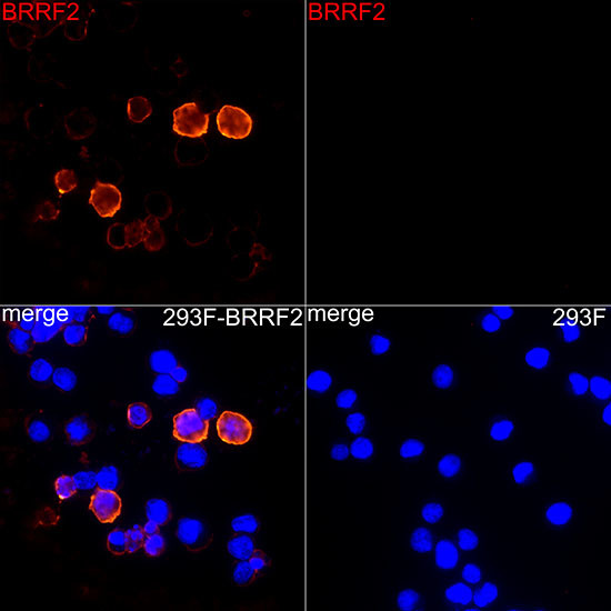 Epstein Barr Virus BRRF2 Antibody in Immunocytochemistry (ICC/IF)
