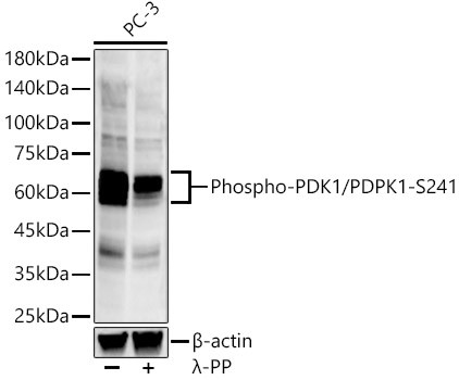 Phospho-PDPK1 (Ser241) Antibody in Western Blot (WB)