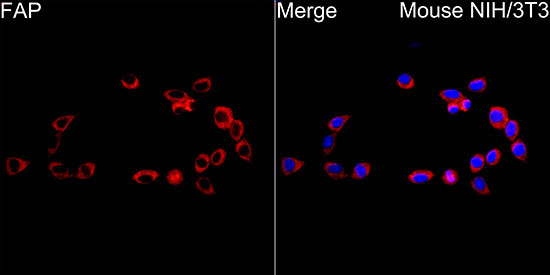 FAP Antibody in Immunocytochemistry (ICC/IF)