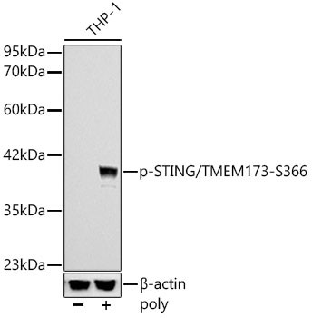Phospho-STING (Ser366) Antibody in Western Blot (WB)
