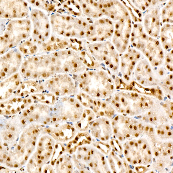Phospho-AKT Pan (Thr450, Thr451, Thr447) Antibody in Immunohistochemistry (Paraffin) (IHC (P))
