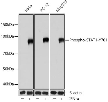 Phospho-STAT1 (Tyr701) Antibody in Western Blot (WB)
