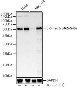 Phospho-SMAD2 (Ser465, Ser467) Antibody in Western Blot (WB)