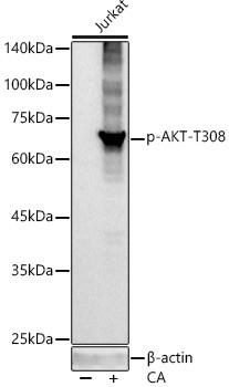 Phospho-AKT1 (Thr308) Antibody in Western Blot (WB)