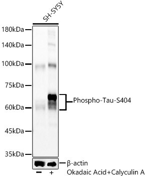 Phospho-Tau (Ser404) Antibody in Western Blot (WB)