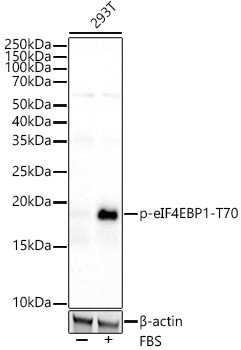 Phospho-4EBP1 (Thr70) Antibody in Western Blot (WB)