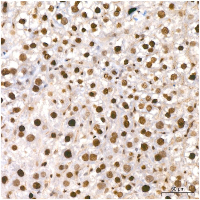 Phospho-CDK2 (Thr160) Antibody in Immunohistochemistry (Paraffin) (IHC (P))