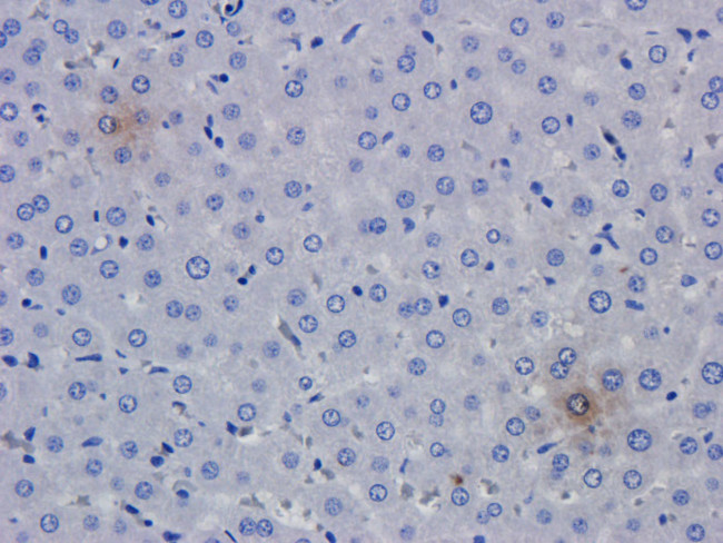 TNF alpha (Humicade Biosimilar) Antibody in Immunohistochemistry (PFA fixed) (IHC (PFA))