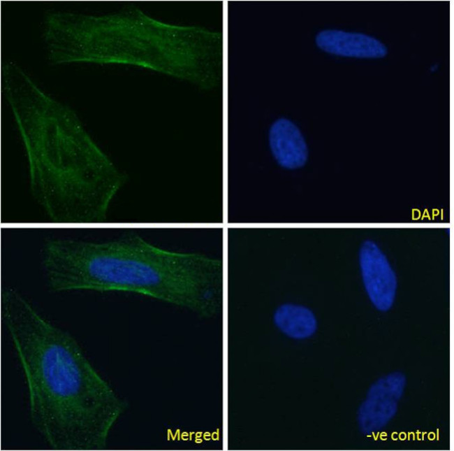 Nimotuzumab Chimeric Antibody in Immunocytochemistry (ICC/IF)