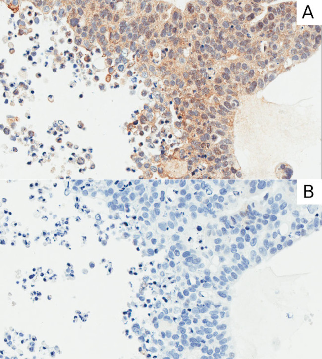 Carbonic Anhydrase IX Chimeric Antibody in Immunohistochemistry (Paraffin) (IHC (P))