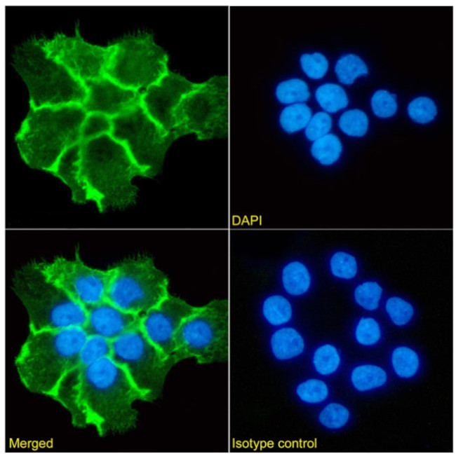 EGFR (Zalutumumab Biosimilar) Antibody in Immunocytochemistry (ICC/IF)