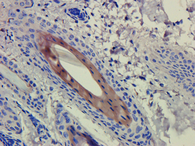 CD4 (Clenoliximab Biosimilar) Antibody in Immunohistochemistry (Paraffin) (IHC (P))