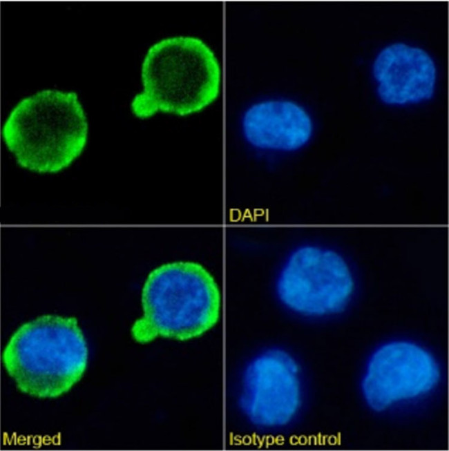 CD20 Chimeric Antibody in Immunocytochemistry (ICC/IF)